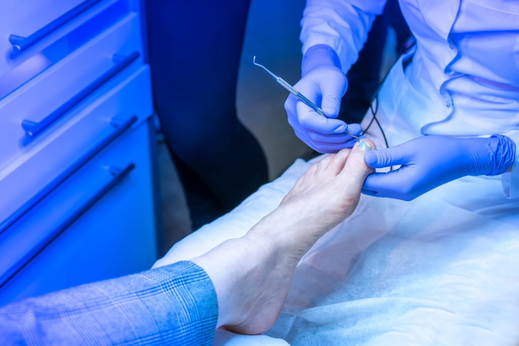 The ABC's Of Ingrown Toenail Surgery : Part C Post-surgical Care ...